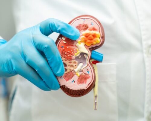 Chirurgia Urologica